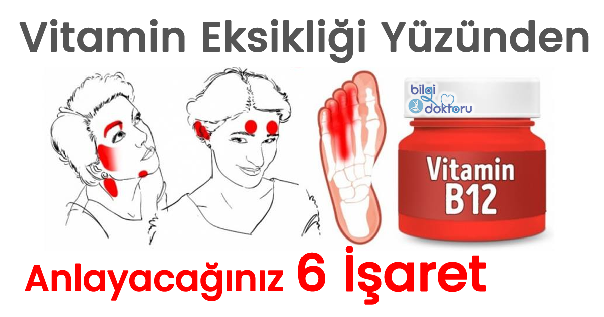 Vitamin Eksikliğinizi Yüzünüzden Anlayacağınız 6 İşaret İnformation