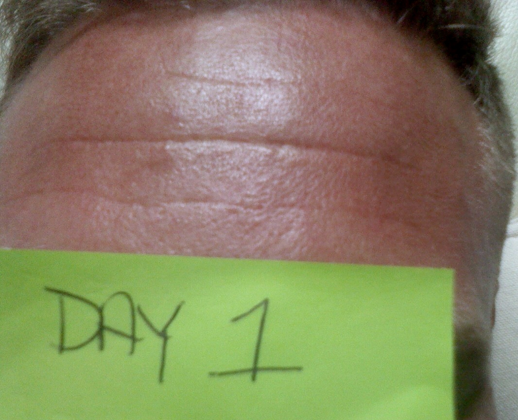 NEUTROGENA® Rapid Wrinkle Repair™ NEUTROGENARapidWrinkle