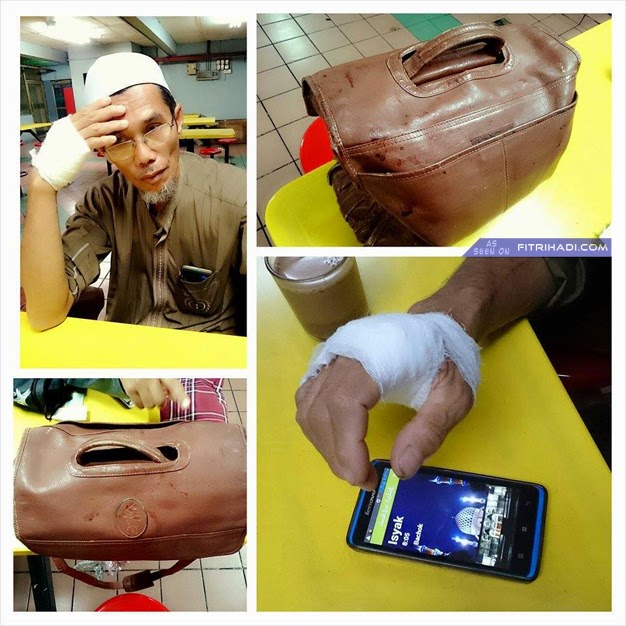 (Kisah) Seorang Pakcik Cedera Dirompak Di Hentian Putra, KL