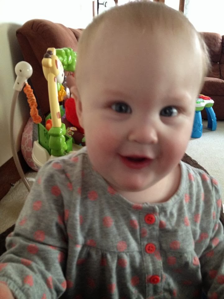 Renae s Journey With Trigonocephaly Metopic Craniosynostosis renae-s-journey-with-trigonocephaly-metopic-craniosynostosis