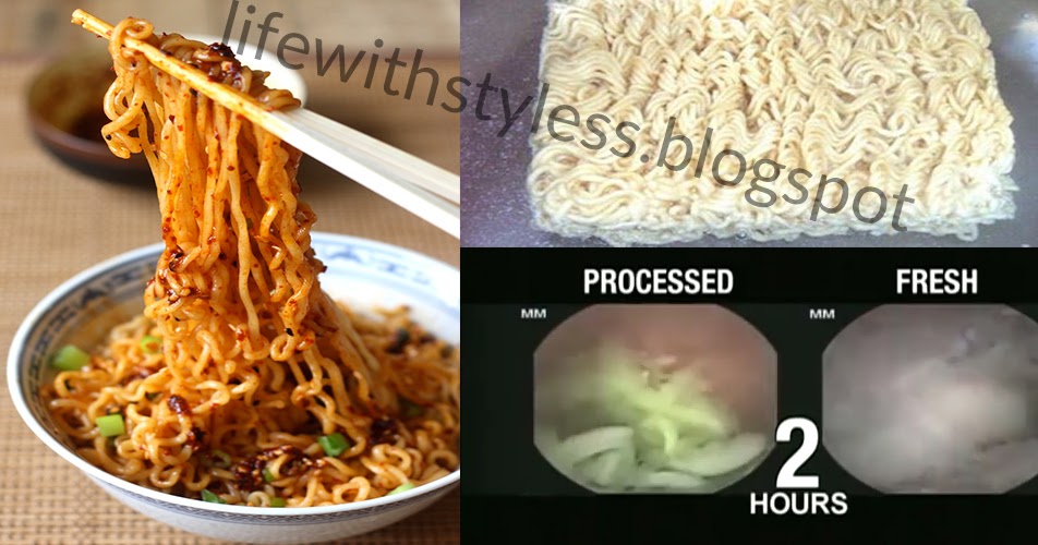 Jams Inside stomach Ramen Noodle digestion goes viral Watch Video