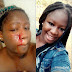 Val Attack:- Lady Got Brutal Beating From Her Boyfriend On Valentine's Day