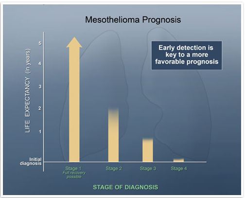 how long to die from mesothelioma