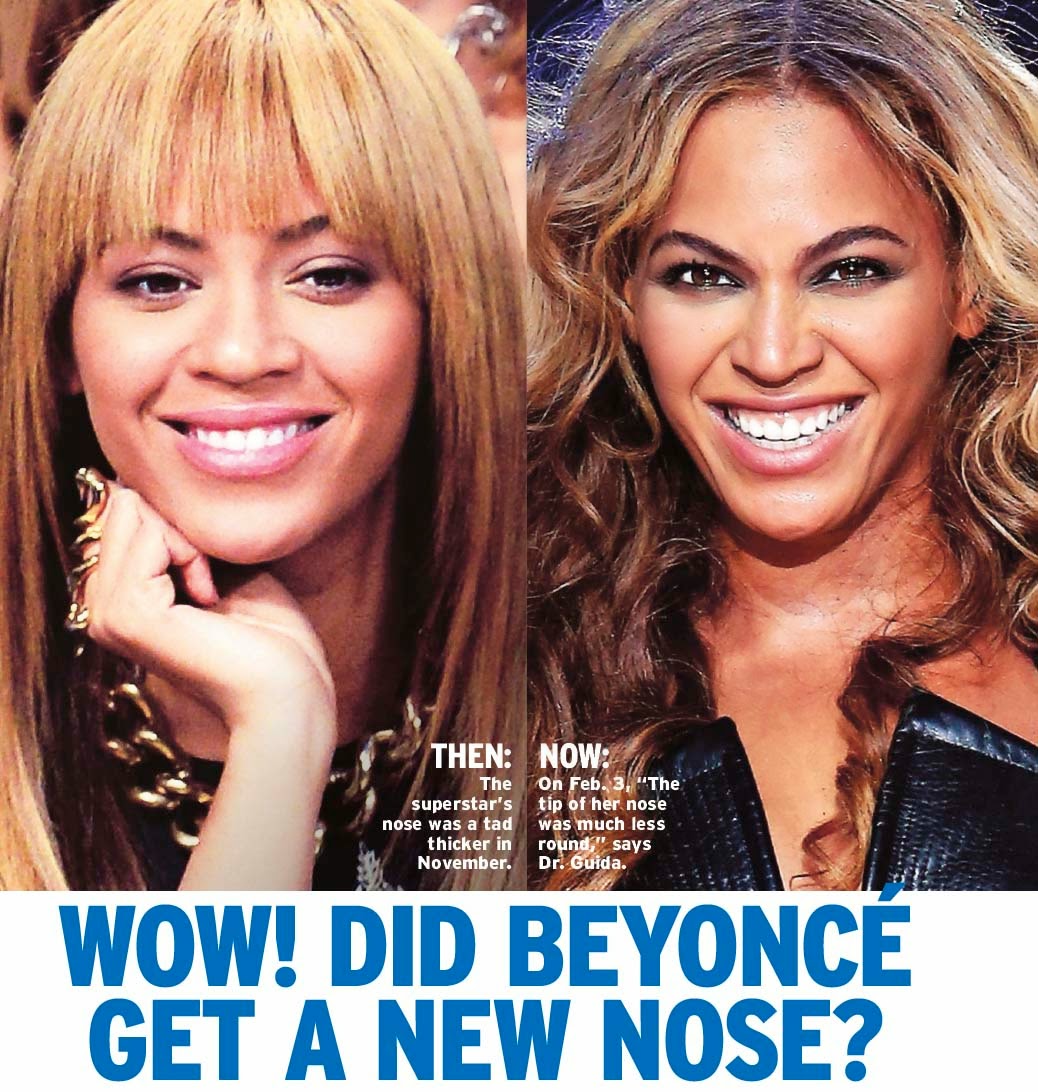 Nose Job Before and After Beyonce Plastic Surgery Before and After