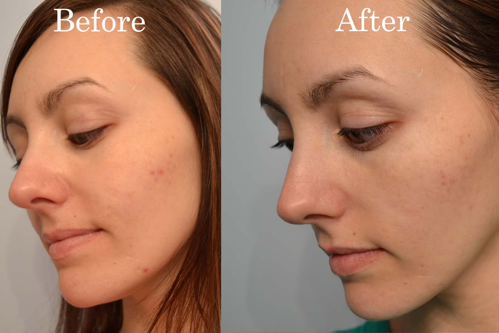 A Love Affair With Eyeliner Kiehl's Dark Spot Corrector Testing and