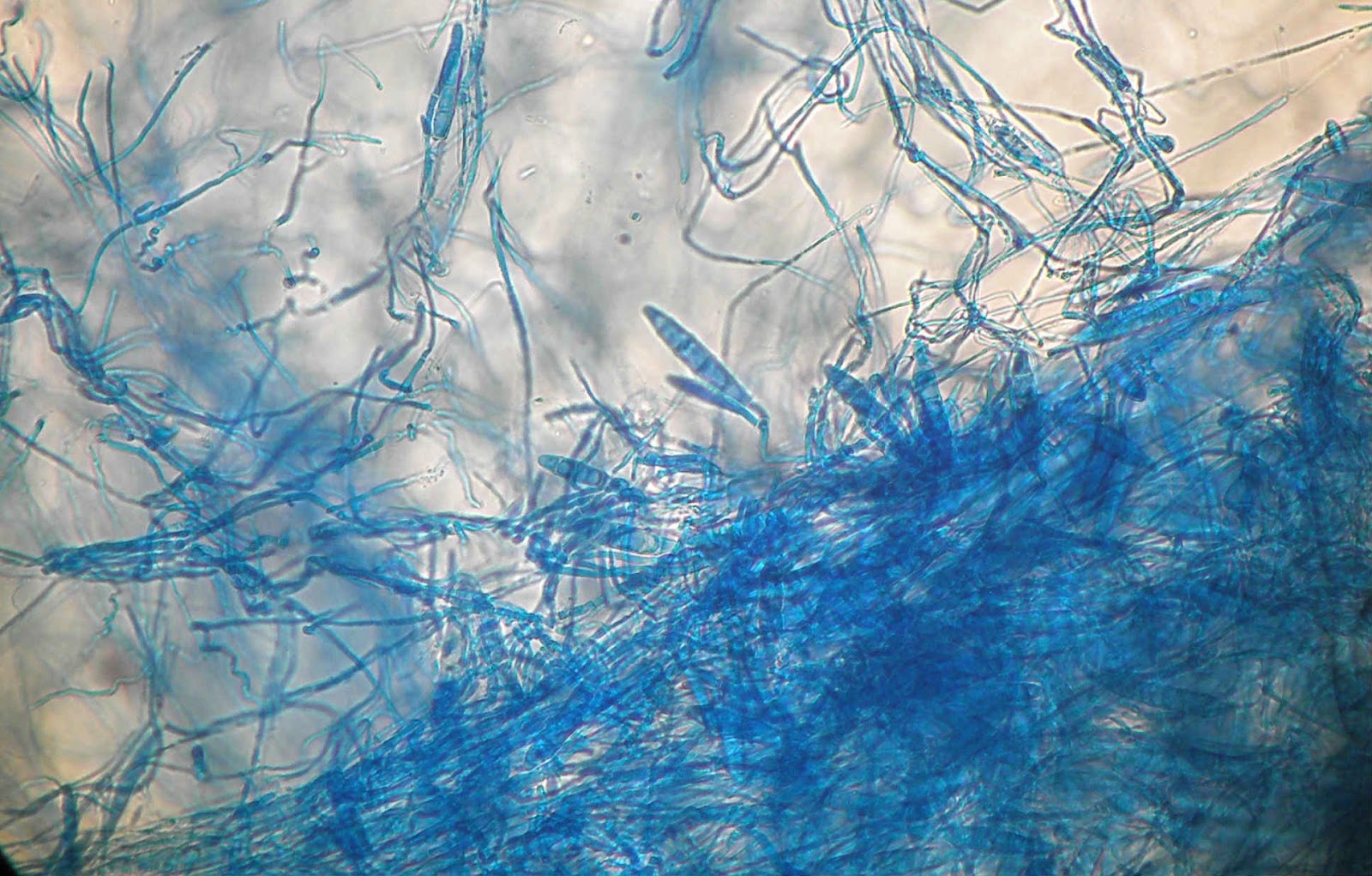 Плесневый грибок рода Microsporum