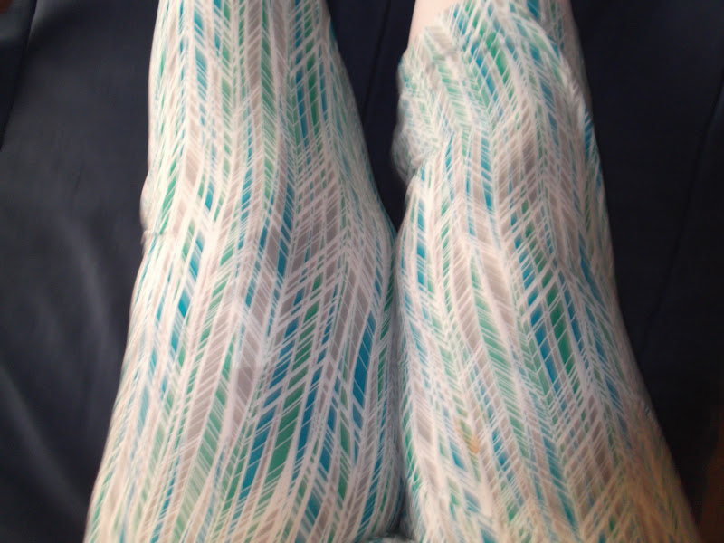 The Hoopless Stitcher Meet My New Knee and Cross Stitch update