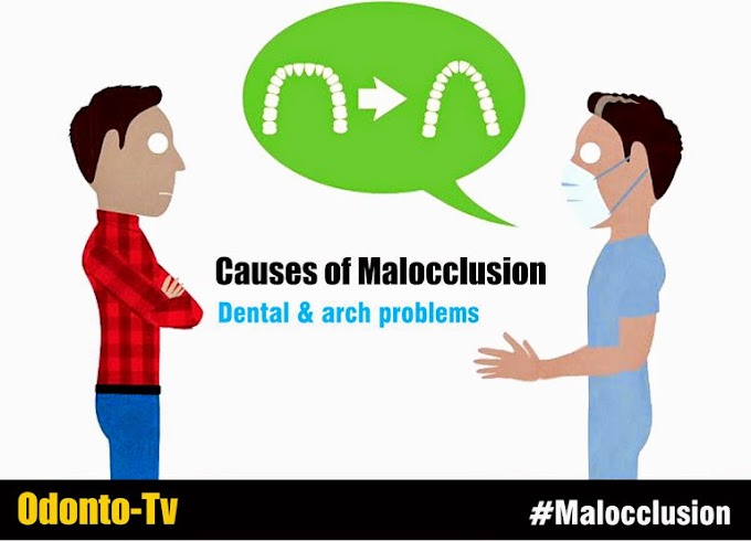 Causes of MALOCCLUSION: Dental & Arch problems