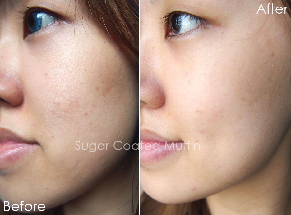 Isabel Lee | Malaysian Beauty & Lifestyle Blogger: Kiehl's Clearly Corrective Dark Spot Solution