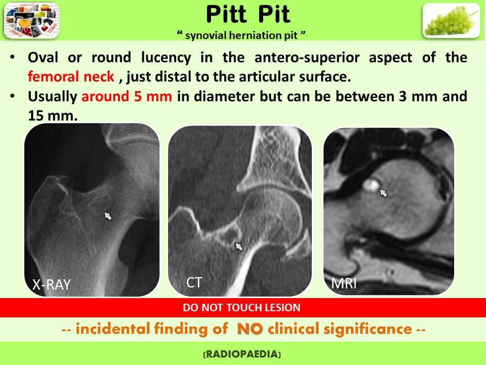 Easy Radiology Don't touch lesions