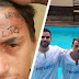 Jovem que teve testa tatuada é batizado em clínica de reabilitação