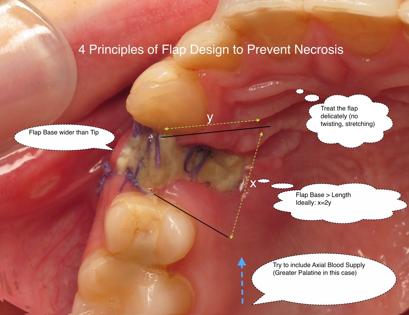 Fonseca Oral Surgery 73