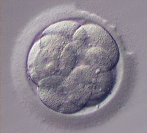 tüp bebek tedavisinde embriyo zarının inceltilmesi