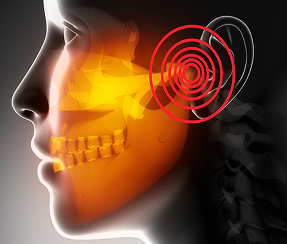 TMJ : Prevention & Cure of Jaw Joint Problems - Directorio Odontológico