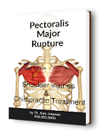blog picture of anatomical shoulder pectoralis major rupture