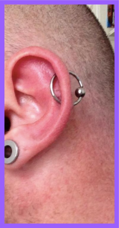 Piercing hafada Category:Male genital