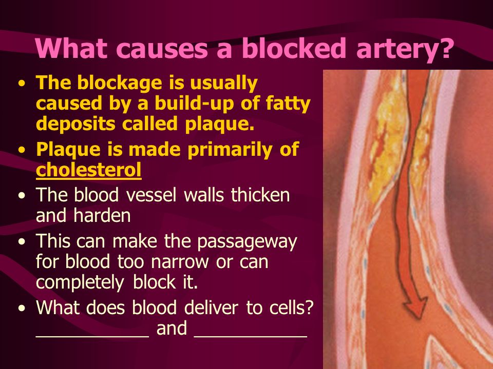 Daveswordsofwisdom.com: Five Signs Of Clogged Arteries - PLEASE READ.