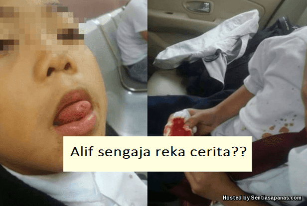 Bukan Buli Tapi Murid Gunting Lidah Sendiri?! Kes Murid Gunting Lidah