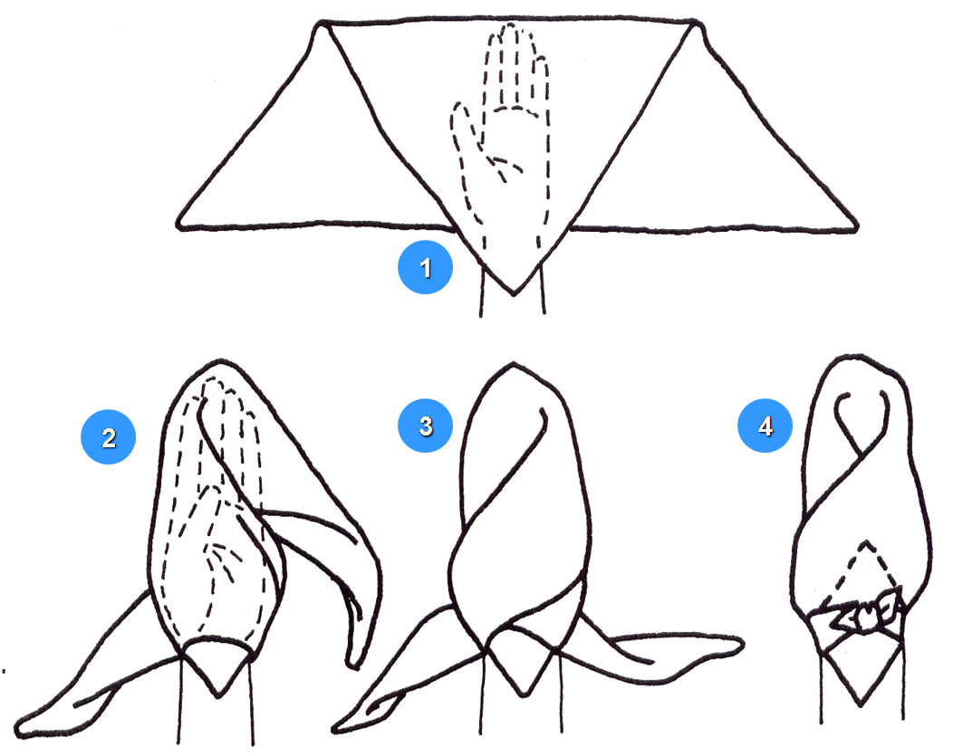 crescentsmexcel: Jenis-Jenis Balutan Luka