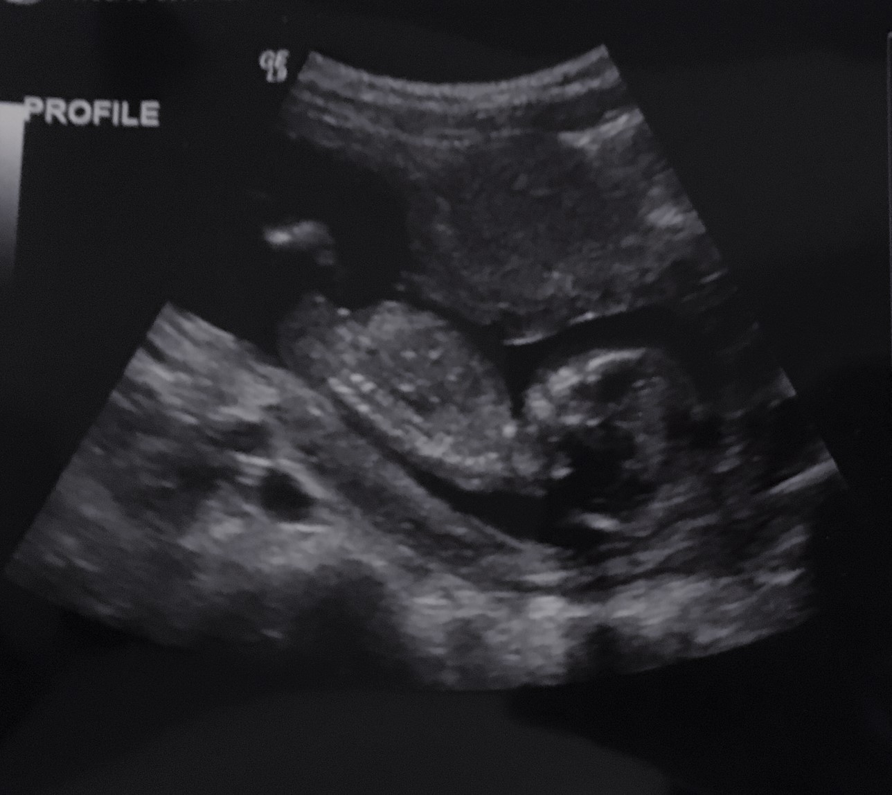 Help Me Grow: What She Didn't Expect While Expecting