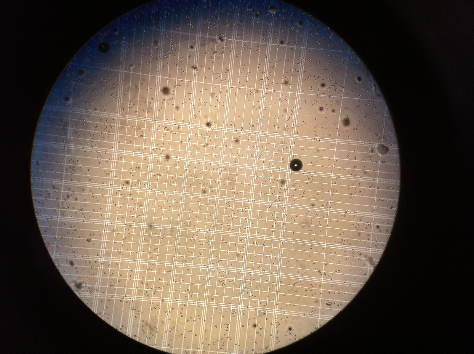 IBG Lab Report LAB 2 MEASUREMENT AND COUNTING OF CELLS USING MICROSCOPE