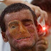 Araras, pueblo maldito por rara enfermedad de la piel