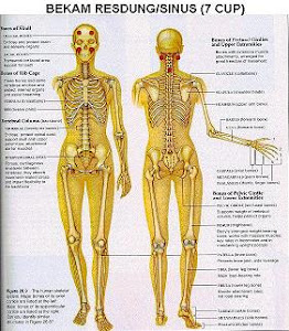 Bekam Resdung/Sinus