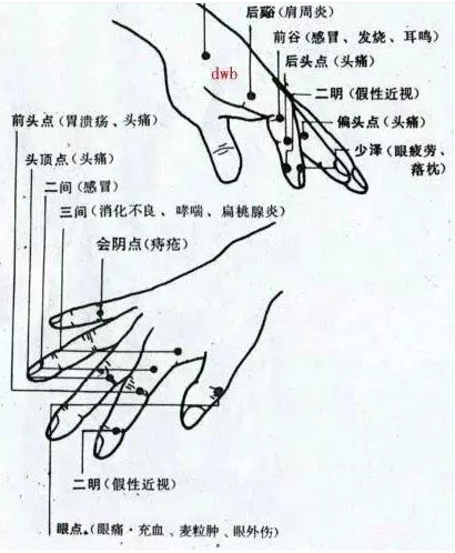 手掌穴道 - 頭痛穴道按摩穴位