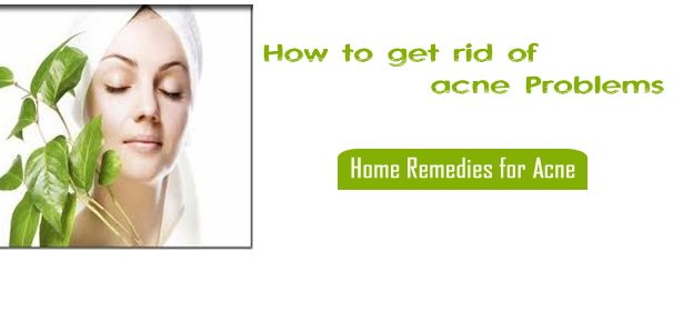 Home Remedies Acne
