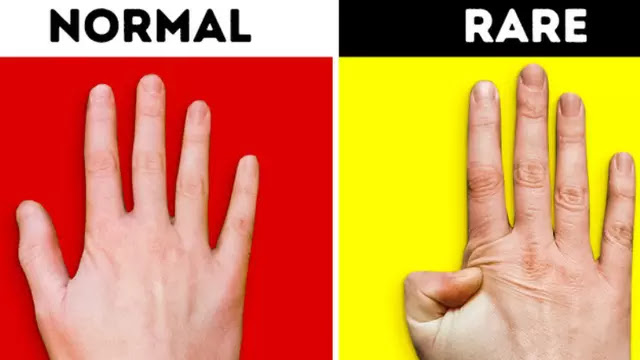 Kamu Adalah Bukan Orang Biasa