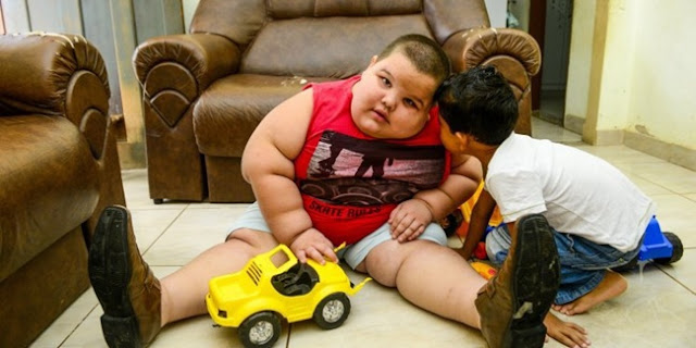 WADUH : Anak Usia 5 Tahun ini Bobotnya 80 Kg.