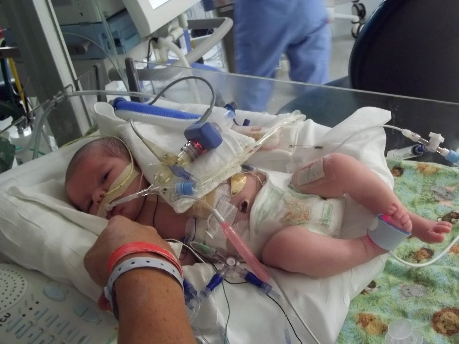 Leavitts 4 Life Hiccups. . . . Post Surgery Days 8 & 9