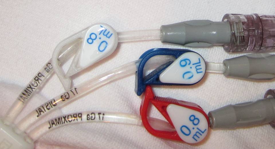 jm's Adventure with Multiple Myeloma Trifusion Hickman Catheter Day 10