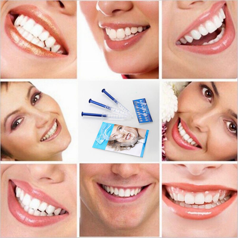 Oral Gel Tooth Whitener Kit