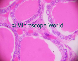 Thyroid Gland captured under microscope at 1000x magnification