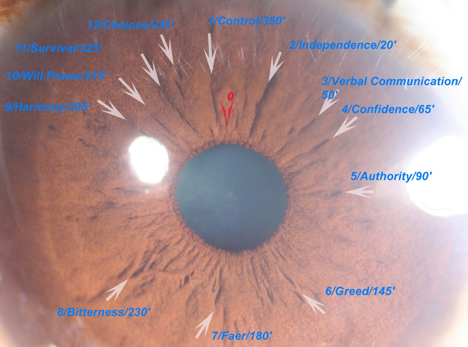 Modern & Multidimensional Iridology Emotional Dynamic of Collarette