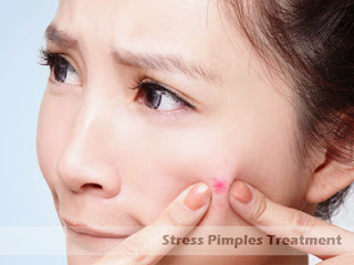 but research and the experiences of acne sufferers Stress Pimples - Yes, They're Acne Too