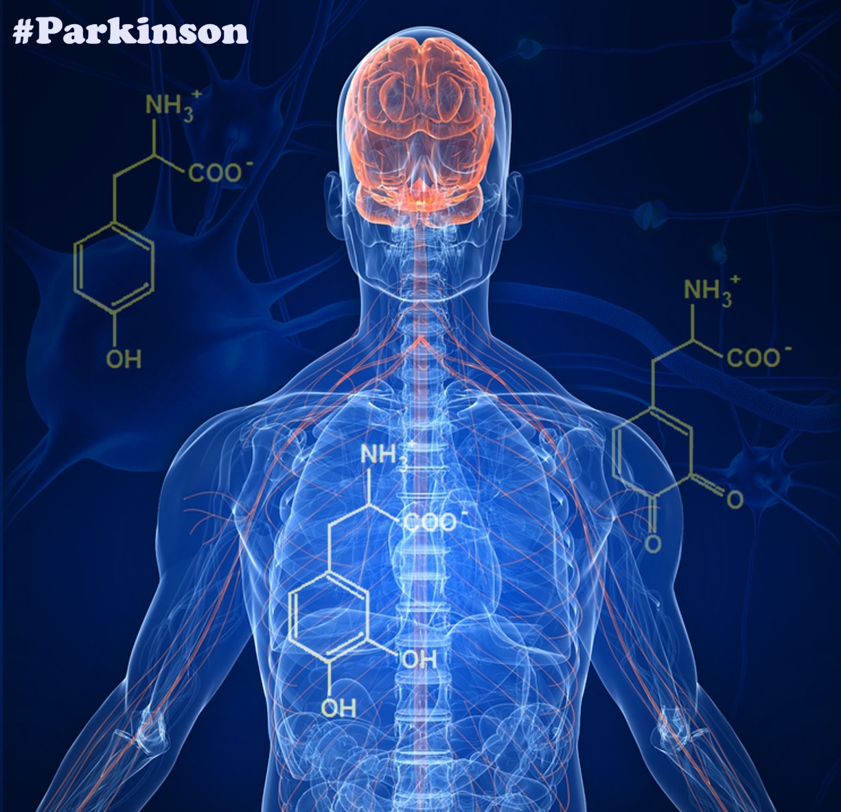 Gejala-Gejala Penyakit Parkinson dan Cara Mengobati - Menit info