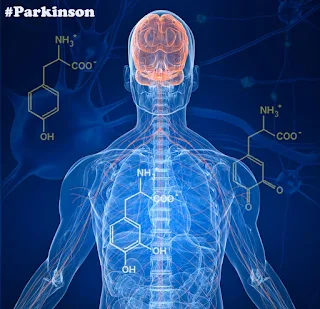 Gejala Penyakit Parkinson dan Cara Mengobati