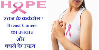 breast-cancer-treatment-prevention-tips-upchar-hindi