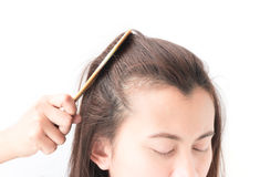 How To Stop Hair Fall And Regrow Hair Naturally Arzo Health