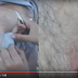 (VIRAL)  (VIDEO) Lelaki Mengadu Gatal Tanpa Henti... Apa yang Dikeluarkan Doktor Dari Badannya Sangat Mengerikan !
