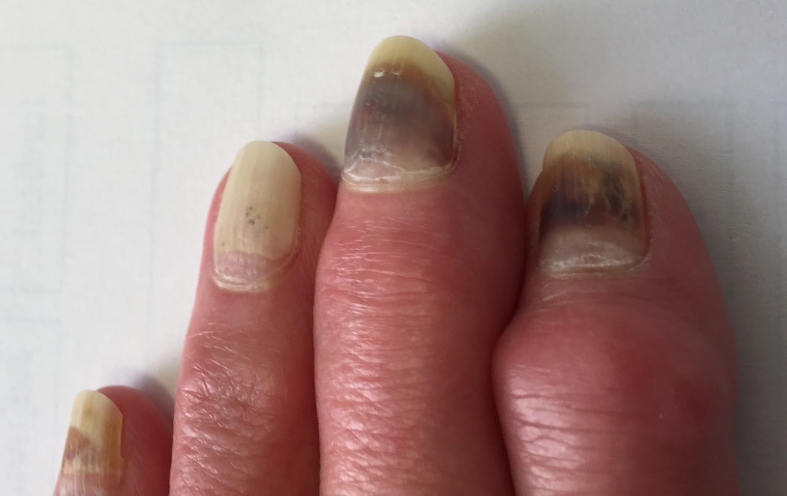 Yes to Life Phytochemicals in African Plant Extracts Stop Chemotherapy