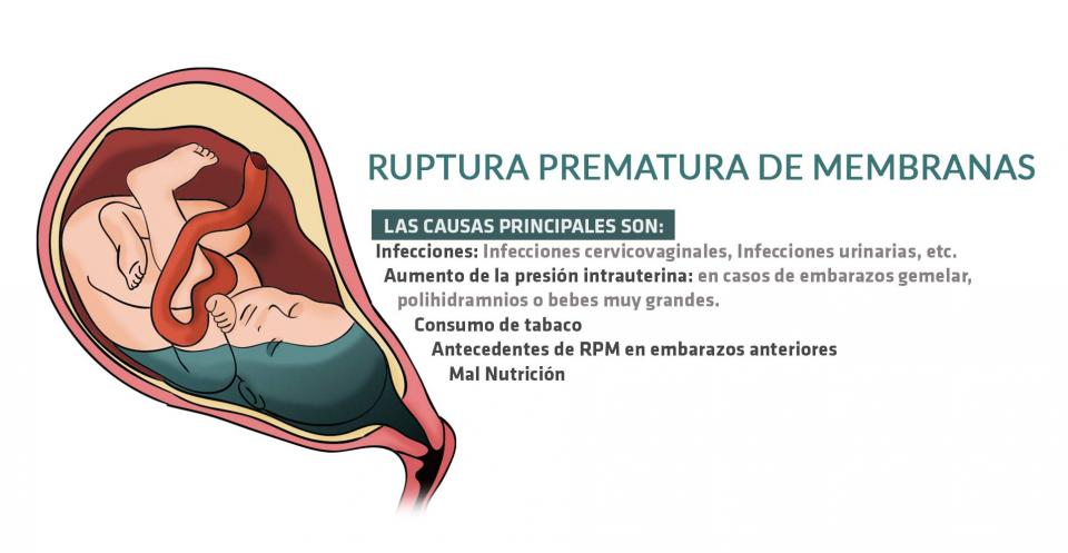 Exemplo De Relatório Falando Sobre Ruptura Prematura Da Membrana Uterina