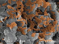contoh gambar thiobacillus denitrificans yang dapat menguraikan senyawa nitrat menjadi nitrit