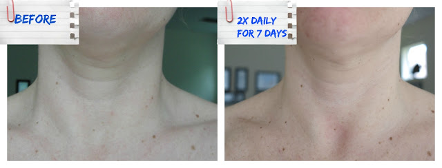 sente neck firming cream review sente neck firming cream review
