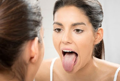 Tìm hiểu về chứng bệnh khô miệng Tìm hiểu về chứng bệnh khô miệng