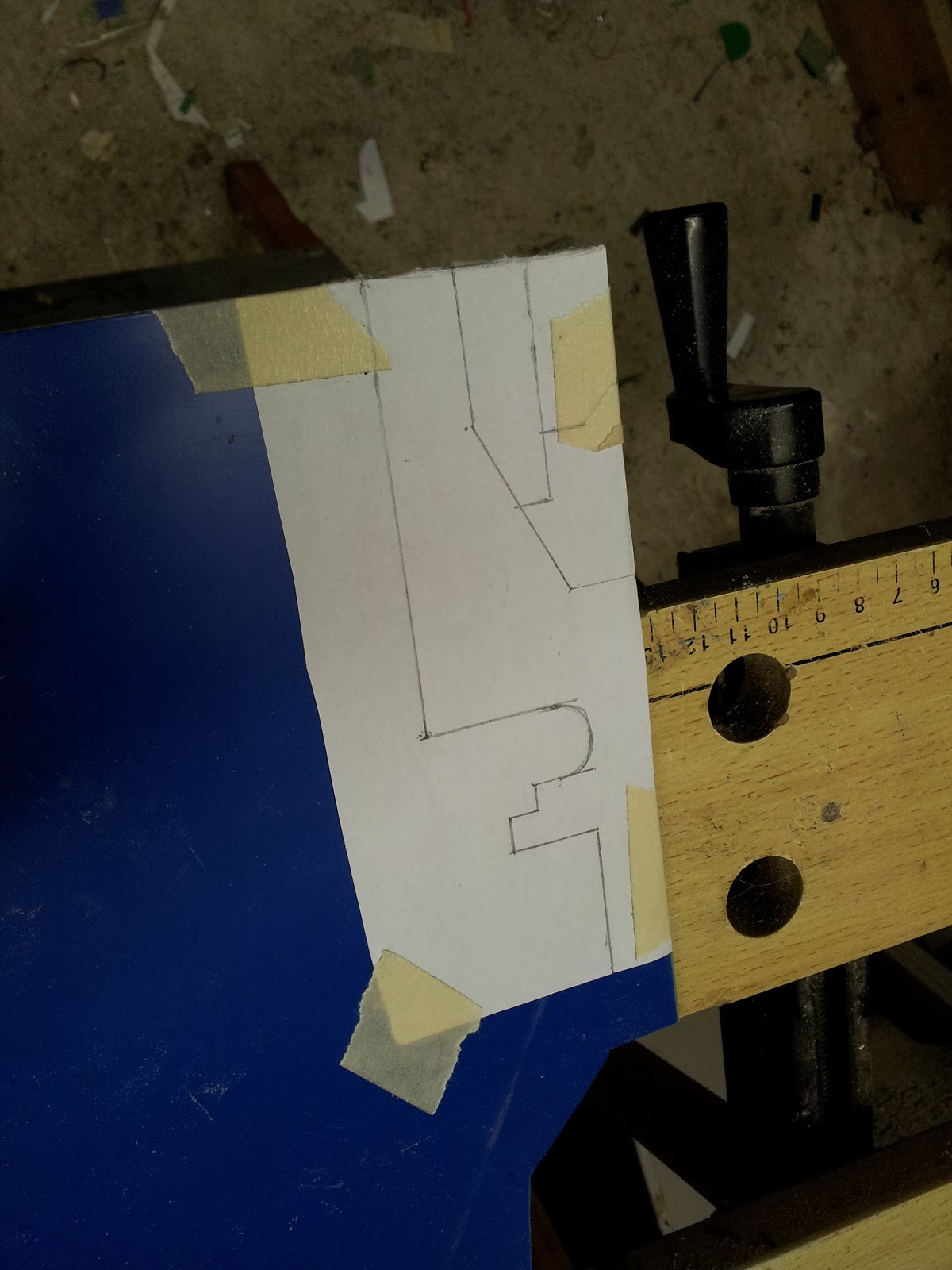 Plasmapheresis used to treat image