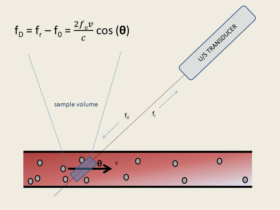 The Pump and the Tubes Pulsed Wave Doppler and Aliasing