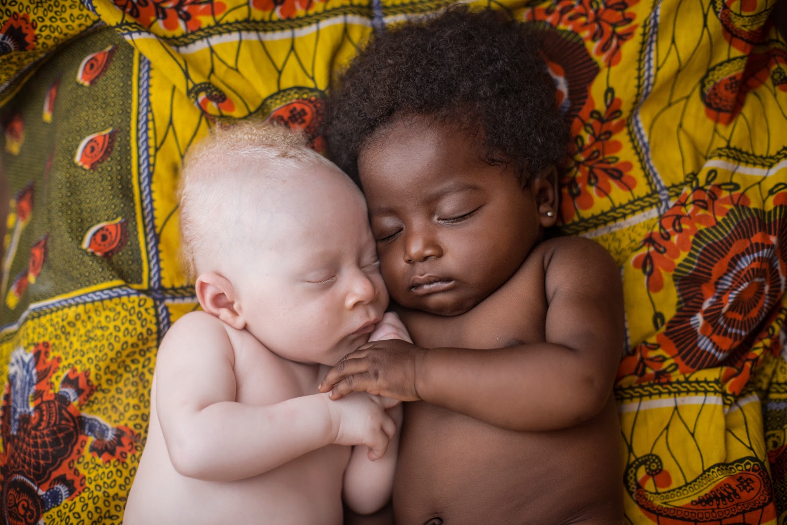 3 WEEKS-OLD NEWBORN WITH ALBINISM HAPPILY SLEEPING WITH HIS COUSIN IN KINSHASA, CONGO PHOTO PATRICIA WILLOCQ - 29 Breathtaking Photographs of The Human Race
